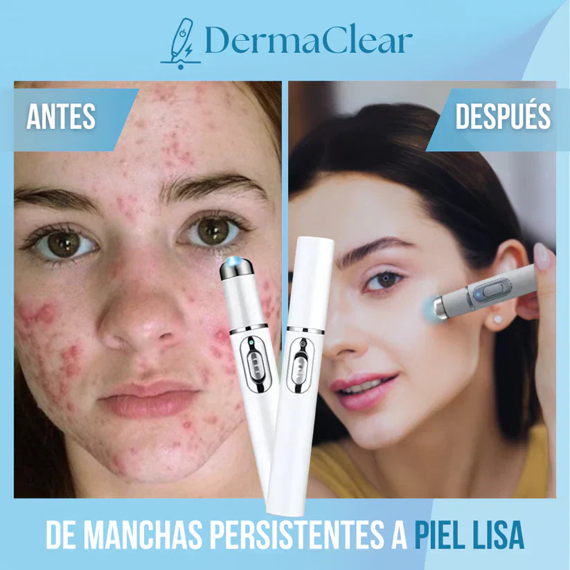 DermaClear - Borra Imperfecciones al instante